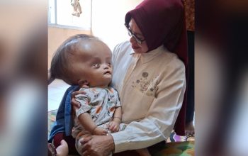 Haru, Maryam Sofyan Puhi Peluk Mail Balita Pejuang Hidrosefalus