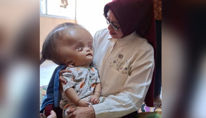 Haru, Maryam Sofyan Puhi Peluk Mail Balita Pejuang Hidrosefalus